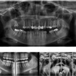 Dunakeszi Tóváros Laser Dental - Korszerű röntgenkép